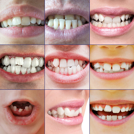 What is orthodontics?